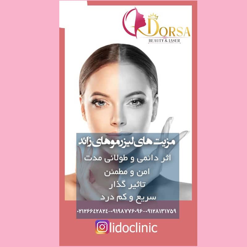 دستگاه لیزر موهای زائد