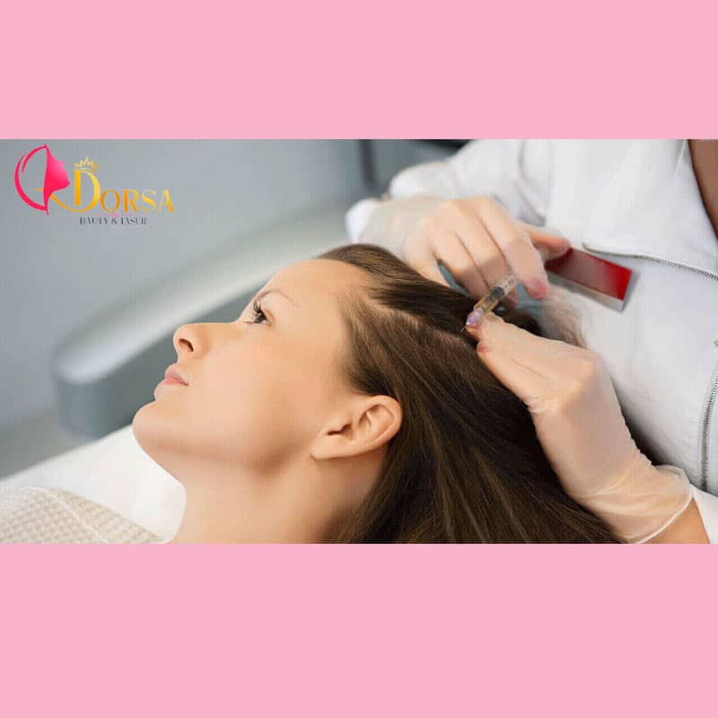 قیمت مزوتراپی مو در شمال تهران