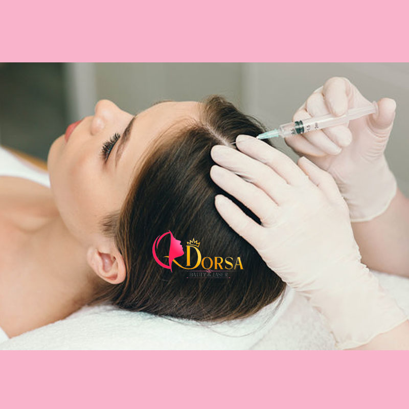 مزوتراپی مو ارزان در تهران