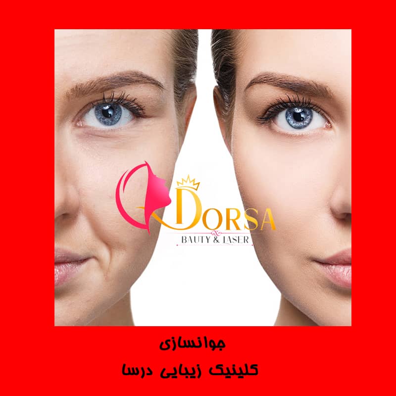 مزوژل تراپی در شمال تهران