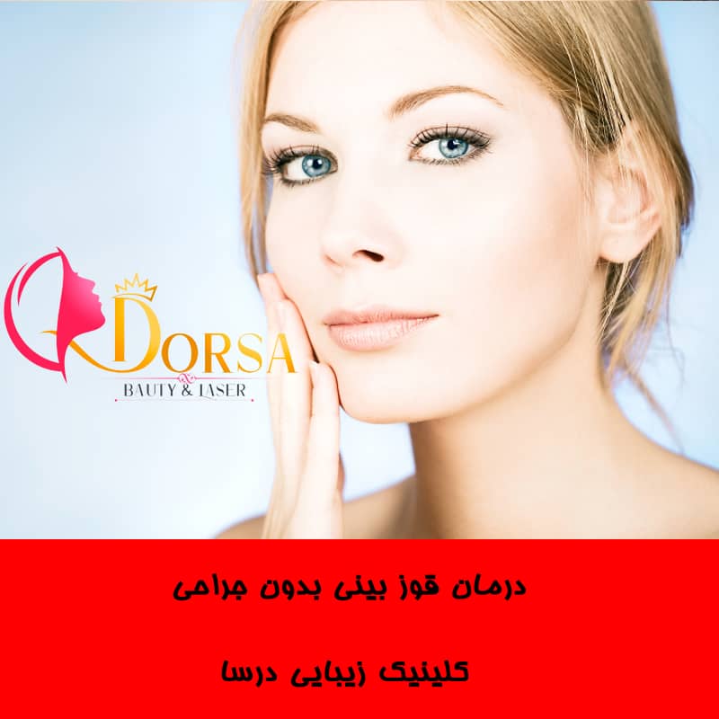 درمان قوز بینی با مزوژل