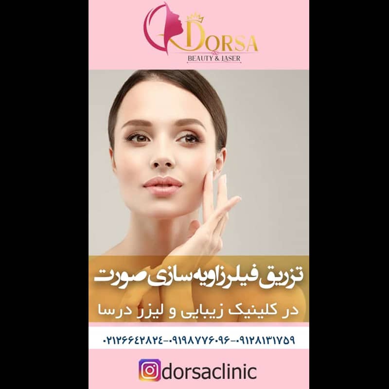 تزریق مزوژل در شمال تهران