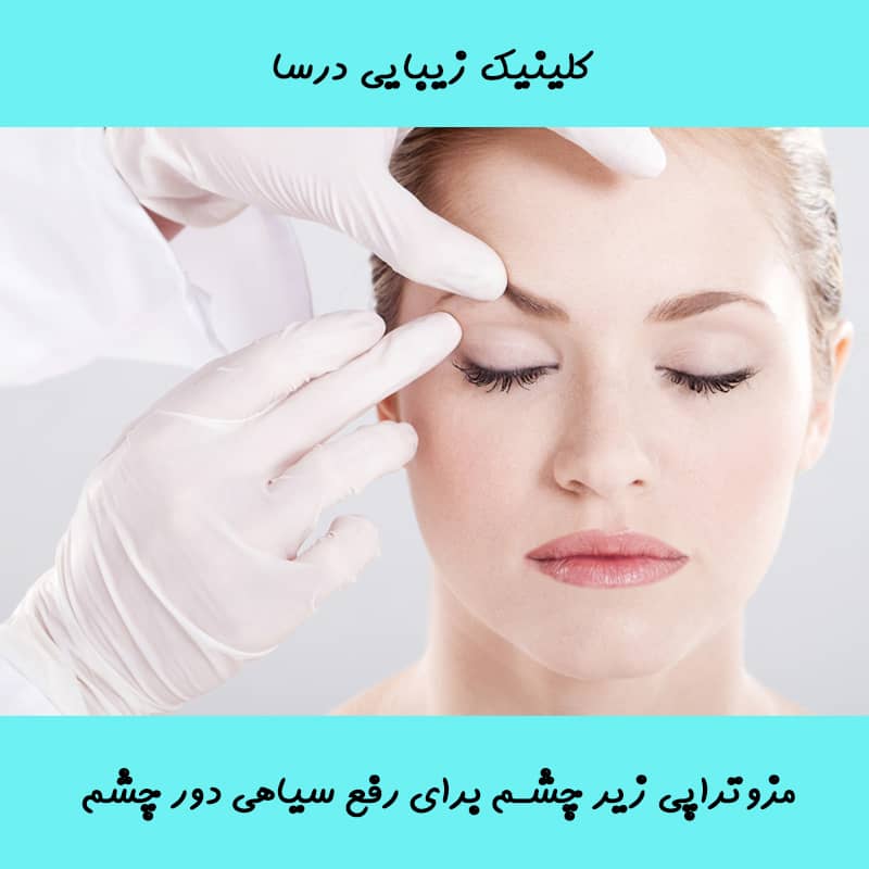 مزوتراپی زیر چشم رفع سیاهی دور چشم در شمال تهران