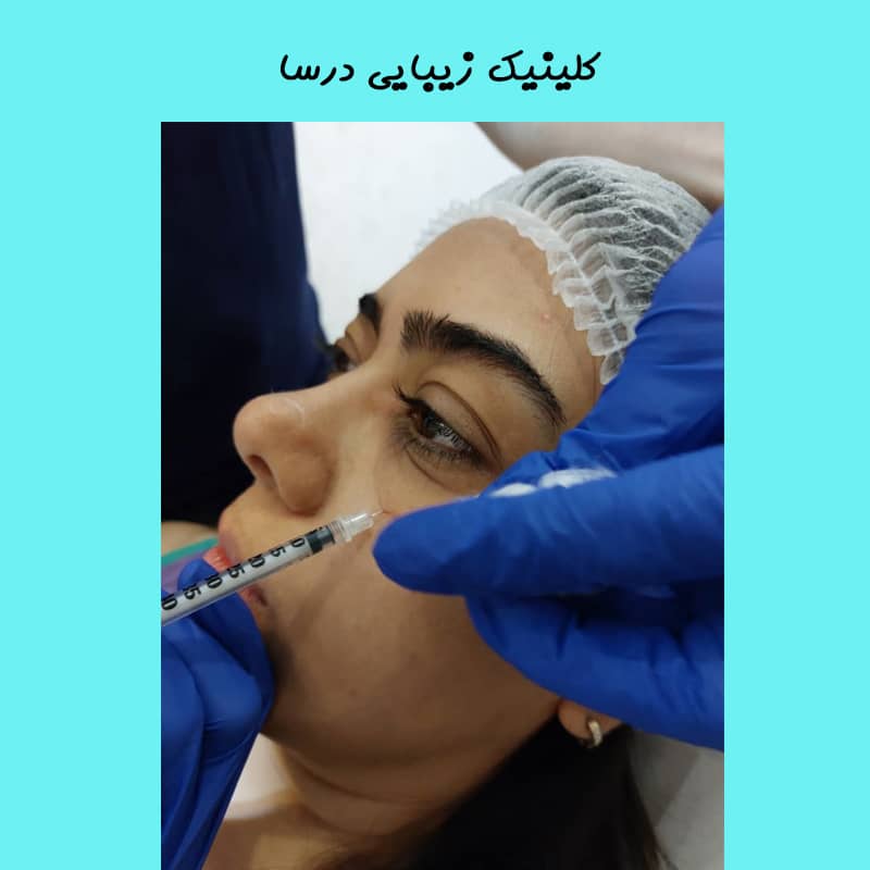 مزوتراپی زیر چشم