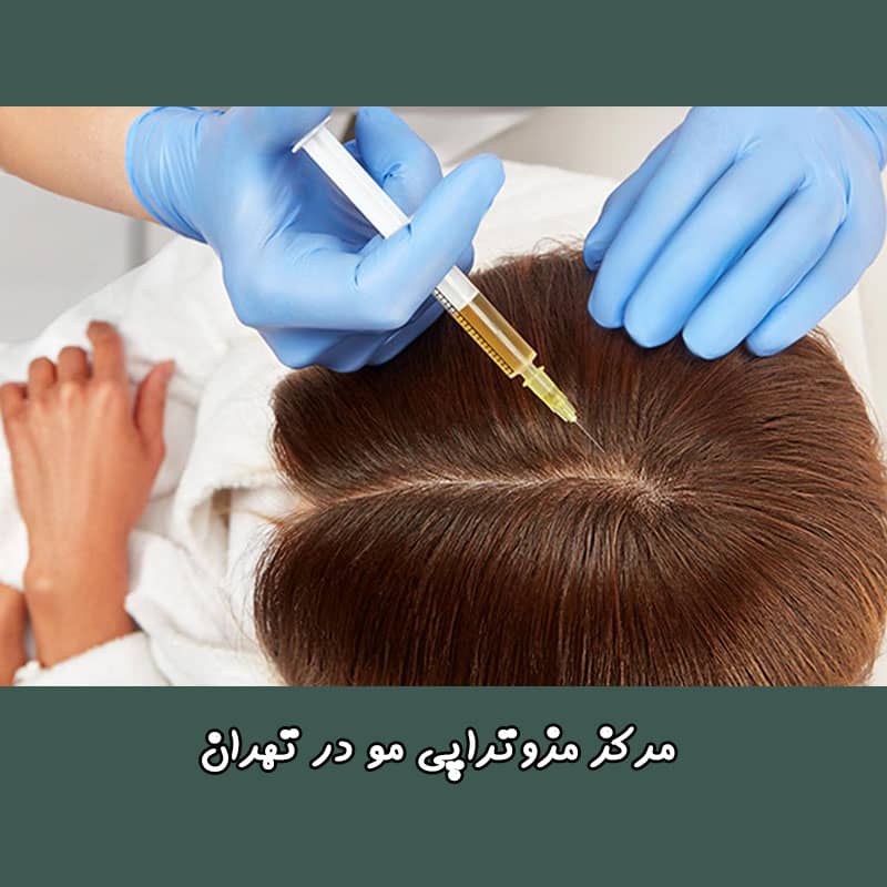 درمان ریزش مو با مزوتراپی در تهران