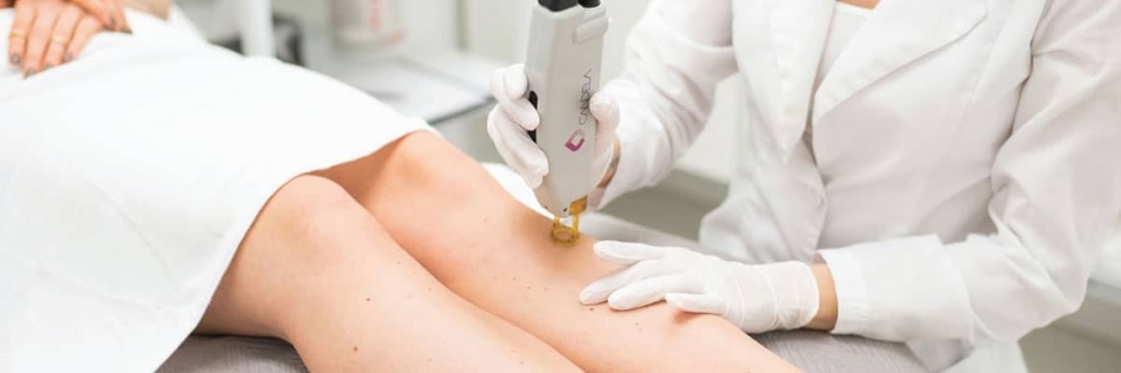 لیزر بیکینی در تهران