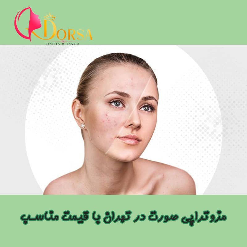 قیمت مزوتراپی صورت در تهران