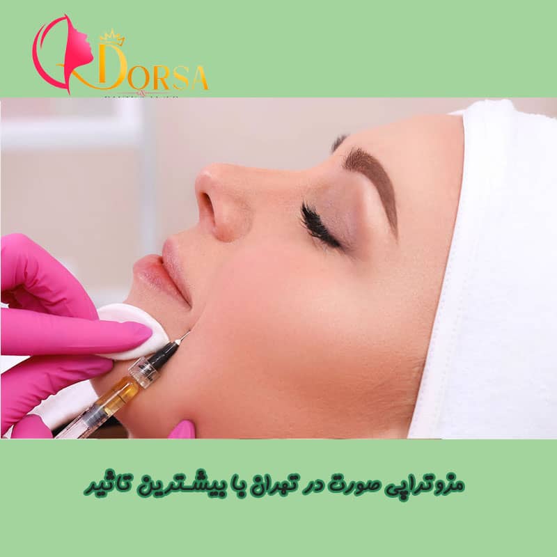 مناسب ترین قیمت مزوتراپی صورت