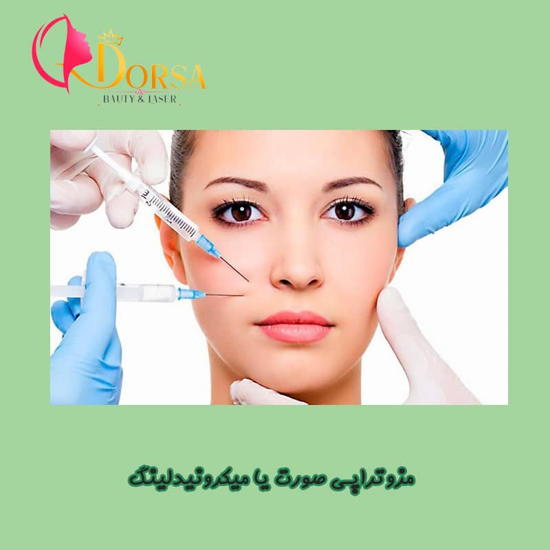 رفع چین و چروک مزوتراپی صورت