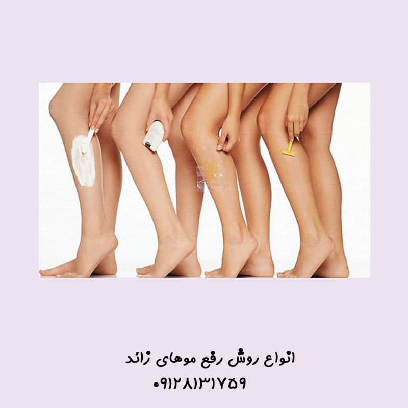 لیزر درمانی بیکینی در تهران