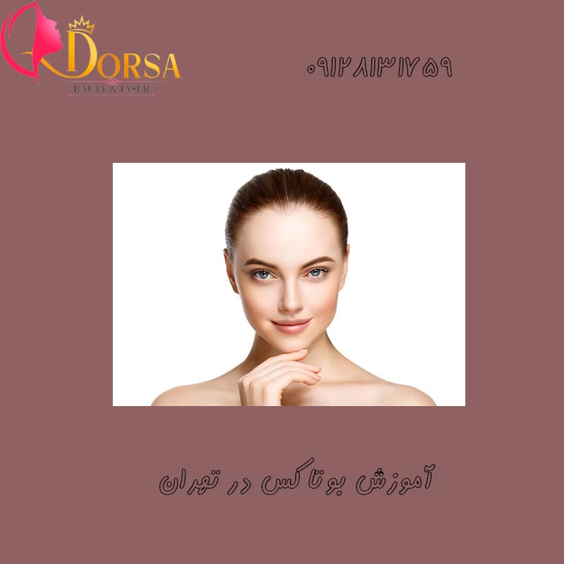 بوتاکس میگرن