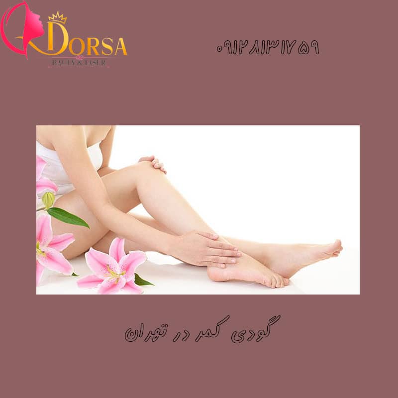 لیزر گودی کمر آقایان