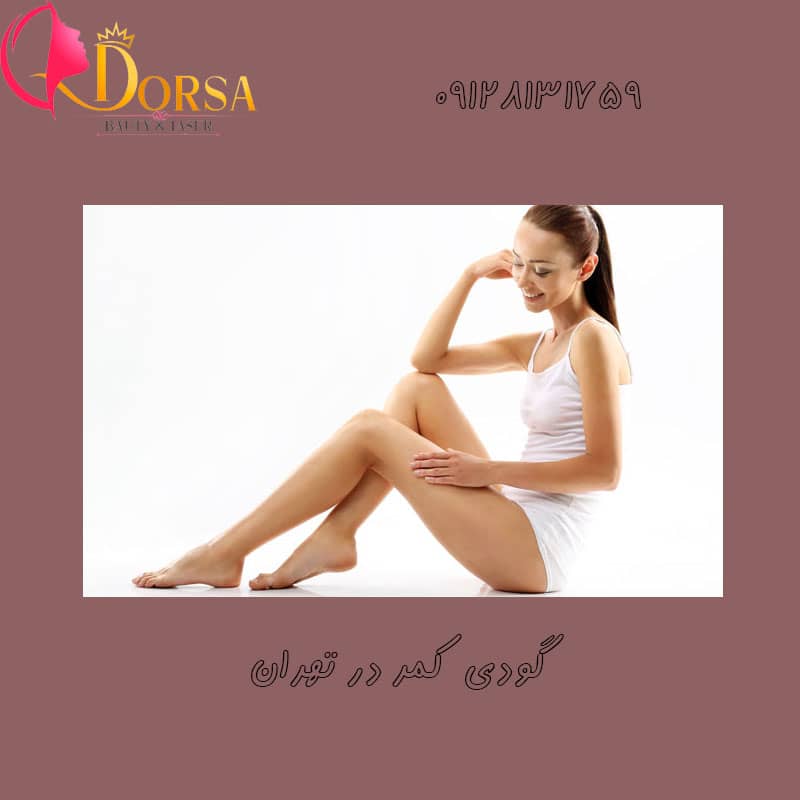 لیزر گودی کمر خانم ها