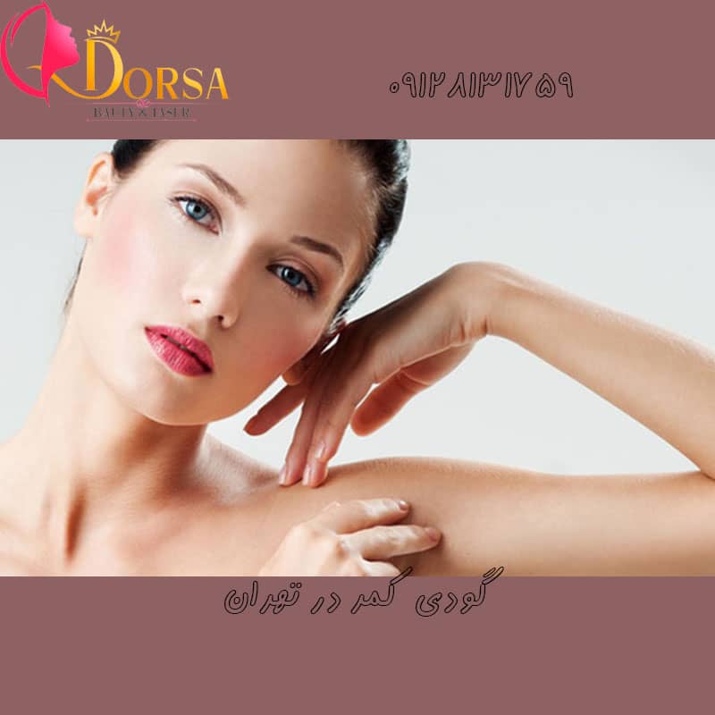 لیزر گودی کمر دختر ها