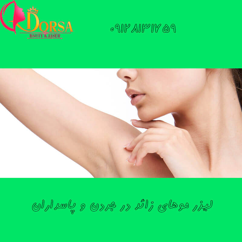 لیزر در ازگل