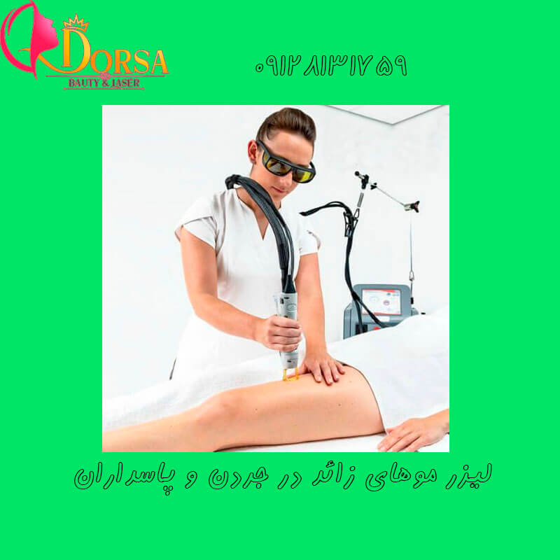 لیزر در مینی سیتی