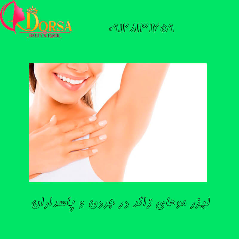 لیزر در اختیاریه