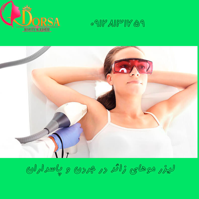 لیزر در چیذر