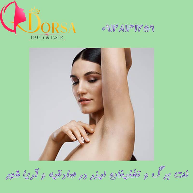 نت برگ لیزر در سعادت آباد