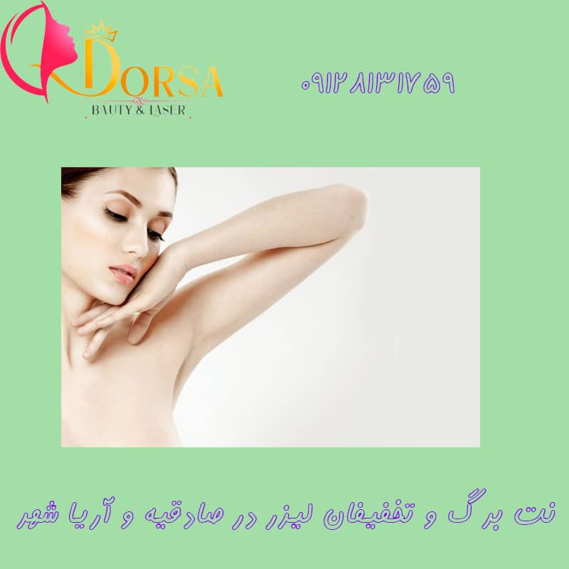 نت برگ لیزر در جنت آباد