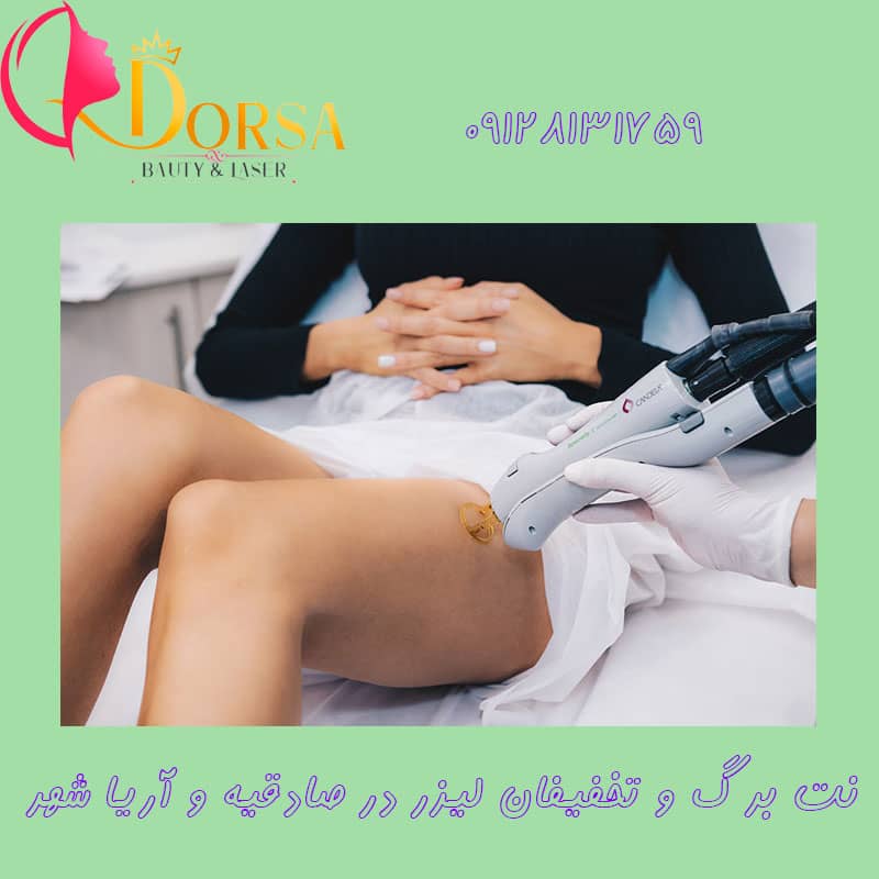 نت برگ لیزر در انقلاب