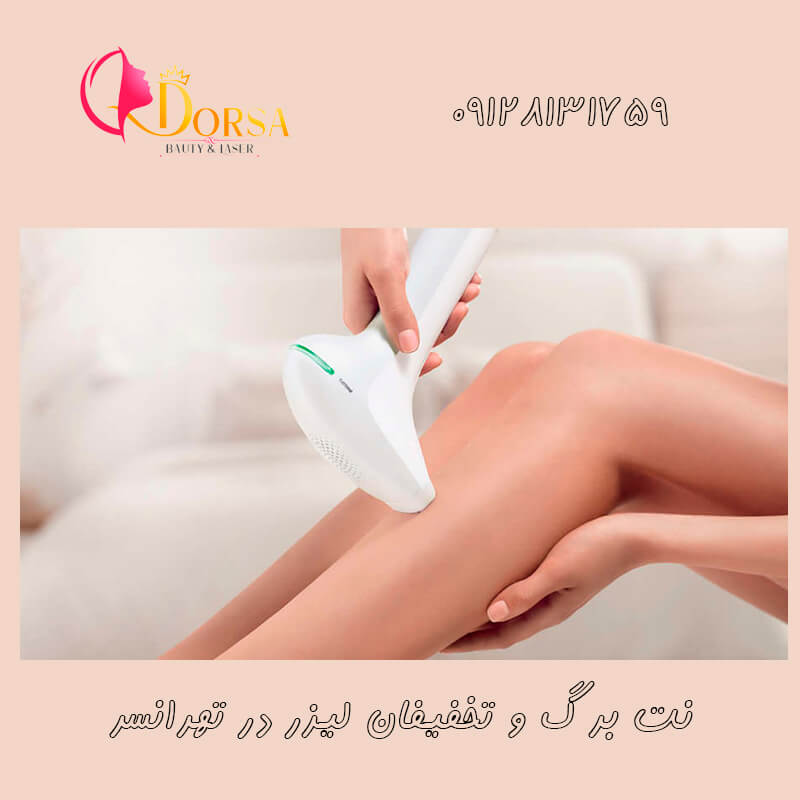 تخفیف لیزر در جنوب تهران