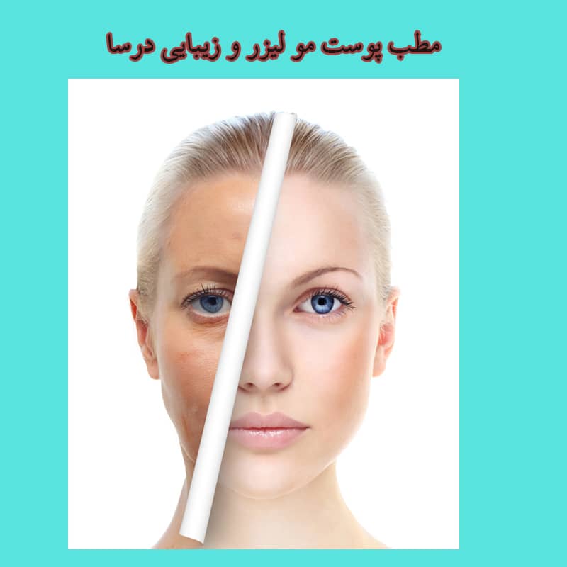 مزوتراپی ارزان قیمت در منطقه 2
