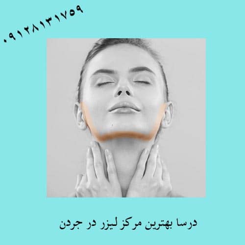 قیمت لیزر در جردن | کلینیک زیبایی درسا
