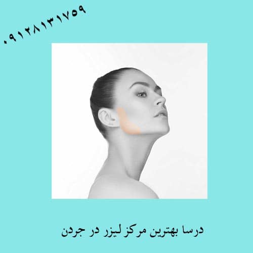 لیزر چانه در جردن | کلینیک زیبایی درسا