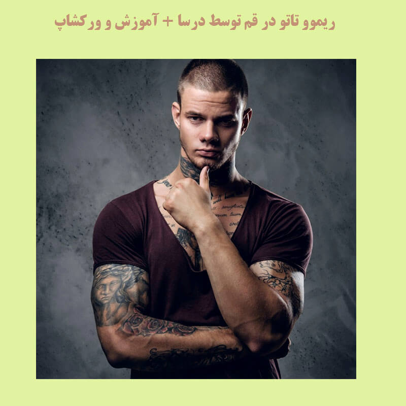 ریمو تاتو در زنبیل آباد | کلینیک زیبایی درسا