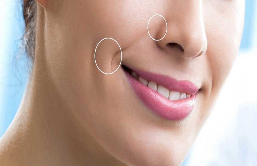 چگونه می توان از ایجاد خطوط خط خنده جلوگیری نمود؟ چگونه می توان از ایجاد خطوط خط خنده جلوگیری نمود؟