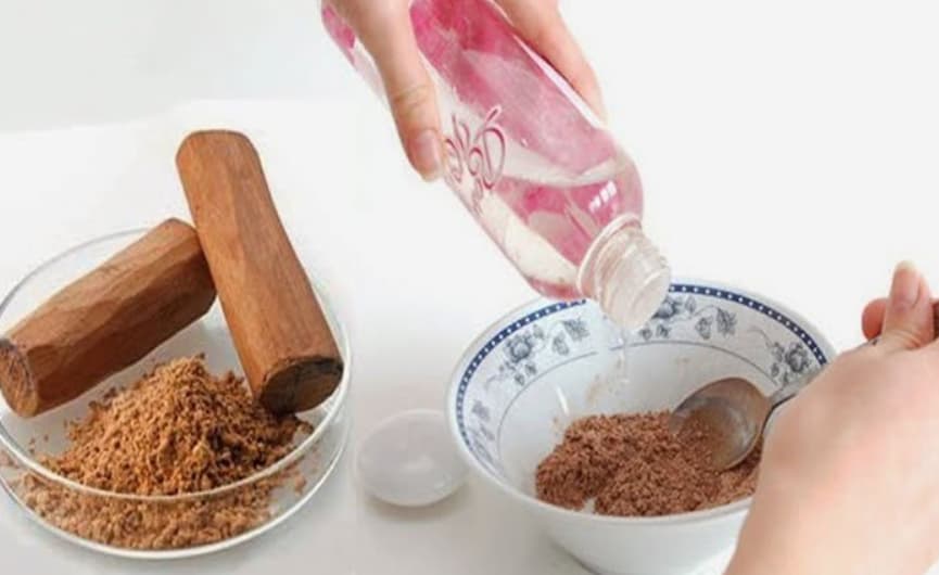 جوش های صورت :پودر درخت صندل و گلاب