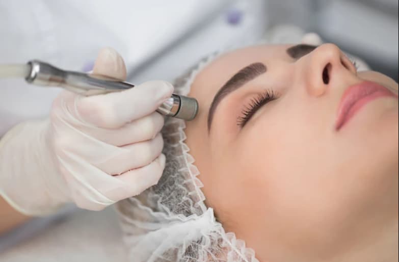 مراقبت های پس از انجام میکرودرم ابریژن ؛