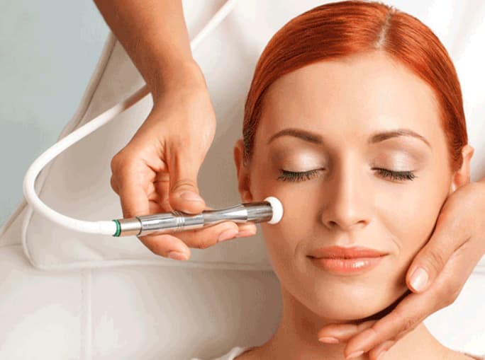 میکرودرم ابریژن