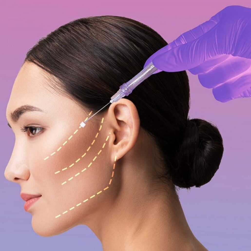 آموزش لیفت نخ در رشت