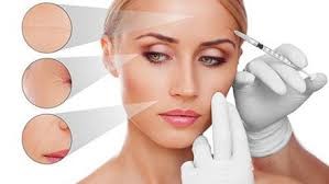 تزریق فیلر چیست ؟ تزریق فیلر چیست ؟