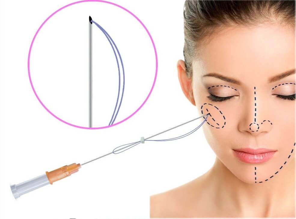 خرید دوره های آموزش لیفت نخ در گرگان