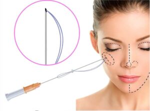 آموزش لیفت نخ در شاهرود