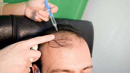 آموزش مزوتراپی در شهرضا