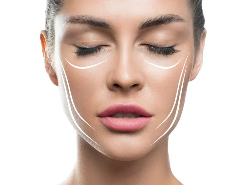 آموزش لیفت نخ در ورامین