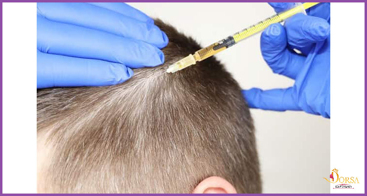 آموزش تزریق مزوتراپی در سمنان