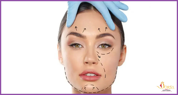 آموزش لیفت نخ در کرمانشاه