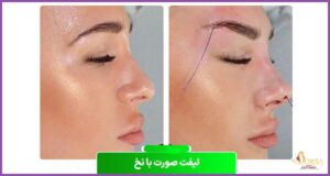 آموزش لیفت نخ در بندر عباس