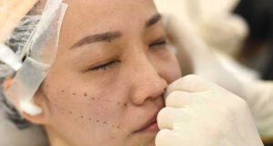 آموزش لیفت نخ در شهریار