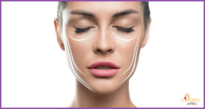 آموزش لیفت نخ در کرمانشاه