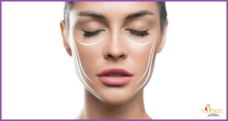 آموزش لیفت نخ در کرمانشاه