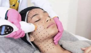 ترماژ ( Thermage ) چیست؟ بررسی مزایا، معایب و جزئیات این روش جدید