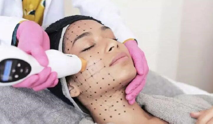 ترماژ ( Thermage ) چیست؟ بررسی مزایا، معایب و جزئیات این روش جدید