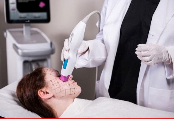 معایب ترماژ ( Thermage )