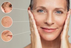 آیا اسکالپترا برای خط خنده و گودی زیر چشم مناسب است ؟